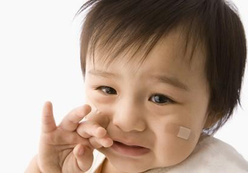 兒童過敏不同階段的表現