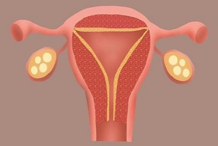 子宮內膜薄總懷不上？